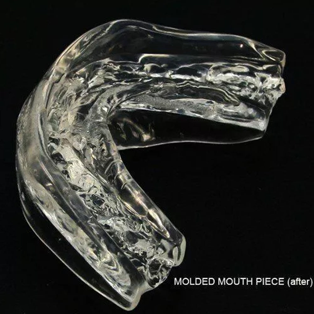 NHS SNORE GUARD - ANTI-SNORING MANDIBULAR MOUTHPIECE DEVICE SLEEP APNOEA AID