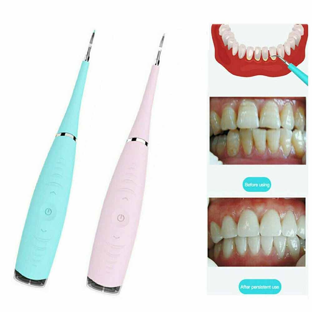 Electric Dental Scaler Tooth Stains Tool Tartar Calculus Plaque Remover Cleaner