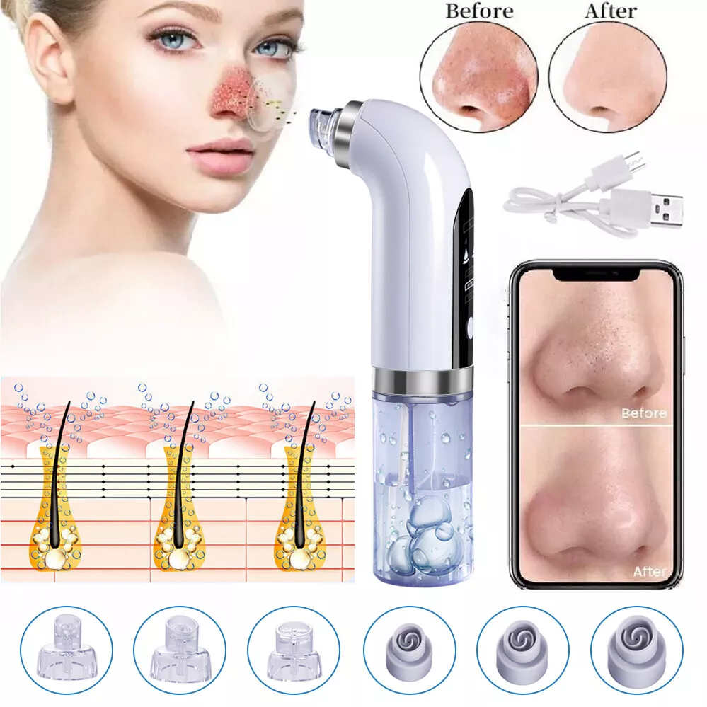Vacuum Blackhead Remover Facial Skin Pore Acne Pimple Suction Cleaner Machine