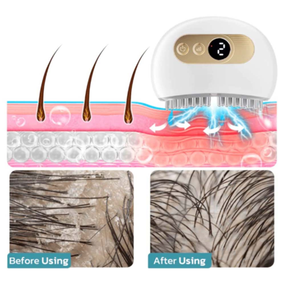 EMS Lifting Facial And Nourishing Scalp Acupoint Massage Device Scalp Relax