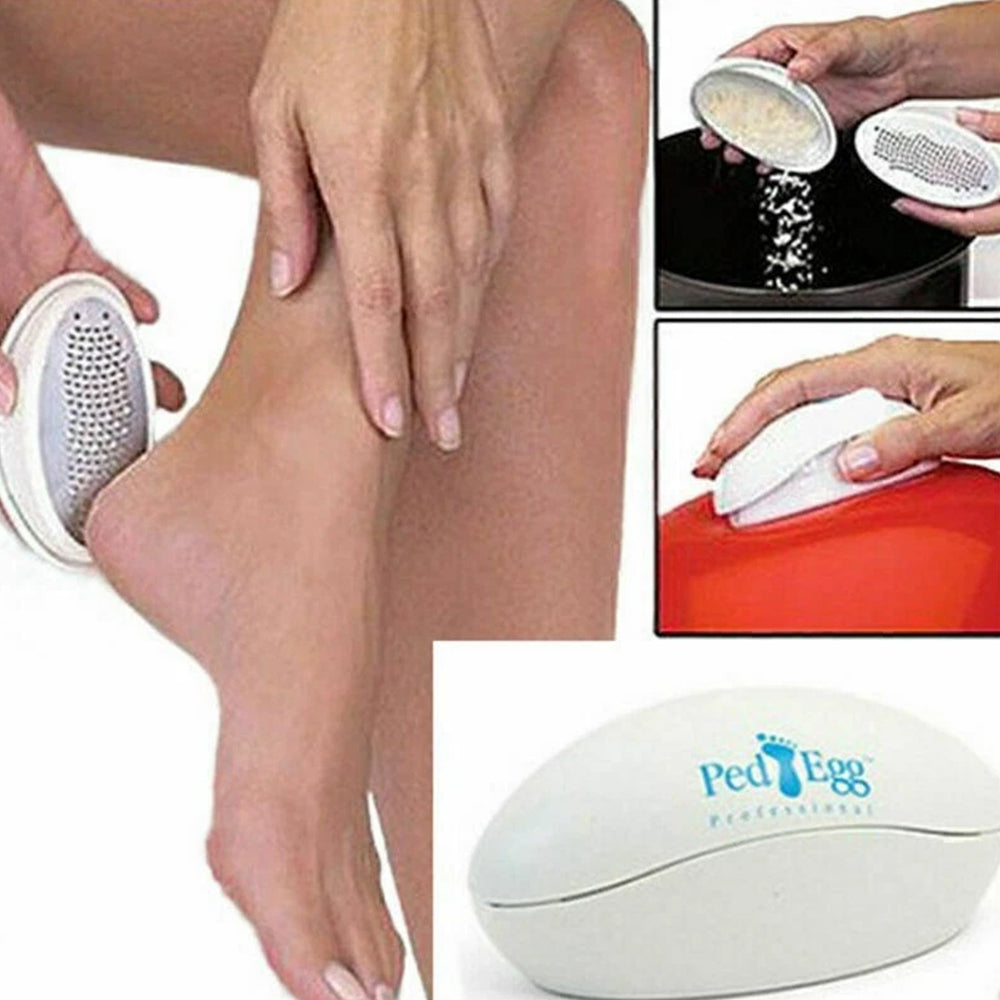 Ped Egg Foot File Callus Remover Foot Care Hard Skin Remover Pedicure Tool