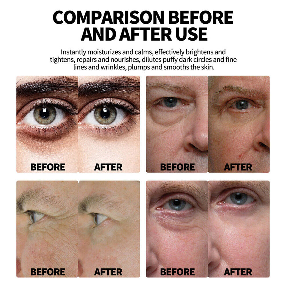 Men's Eye Cream Instant Remove Eye Bags Dark Circles Anti Wrinkle Depuffing Firm