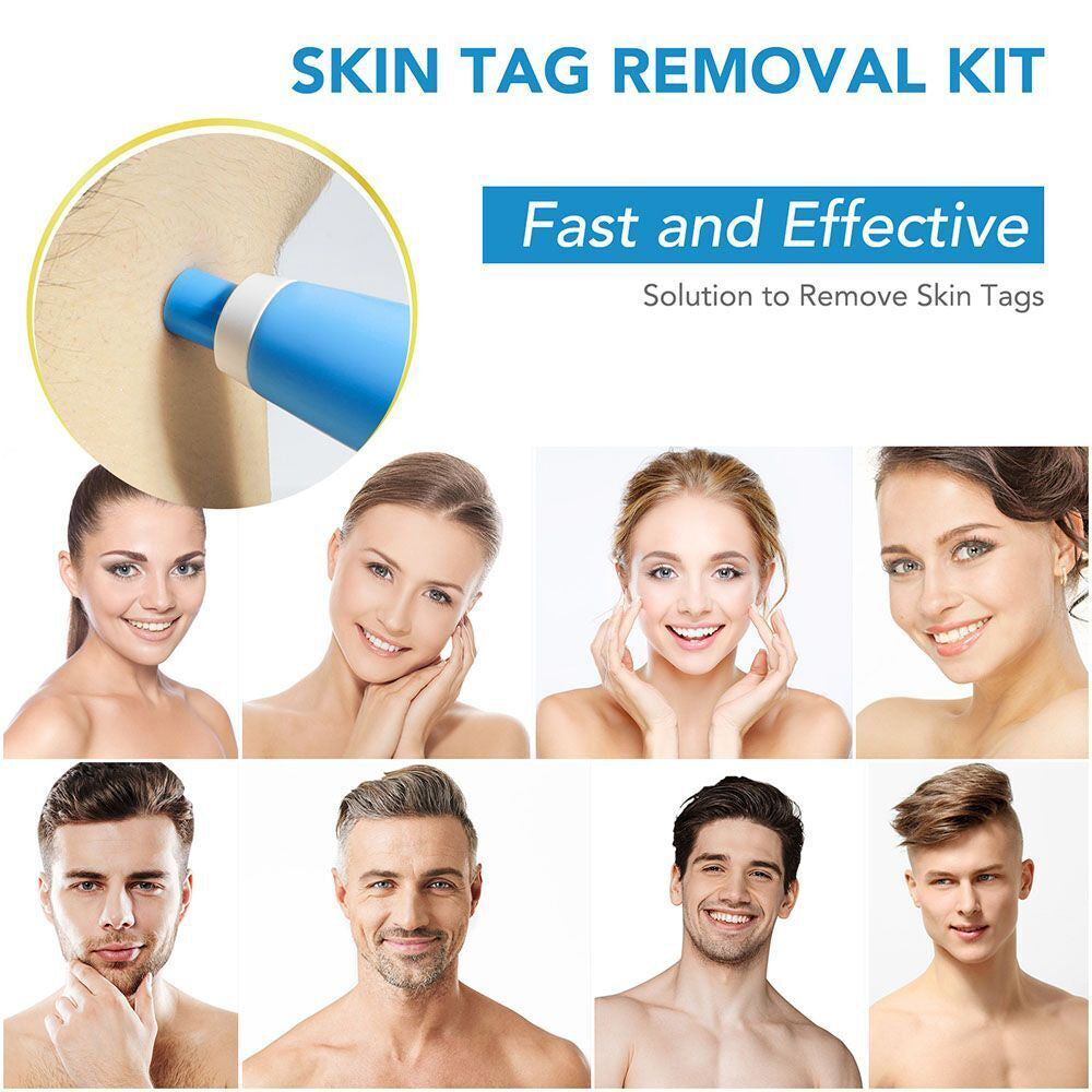 Auto Micro Skin Tag Remover Device Kit Safe Painless Removal 2-8 mm Band Tool