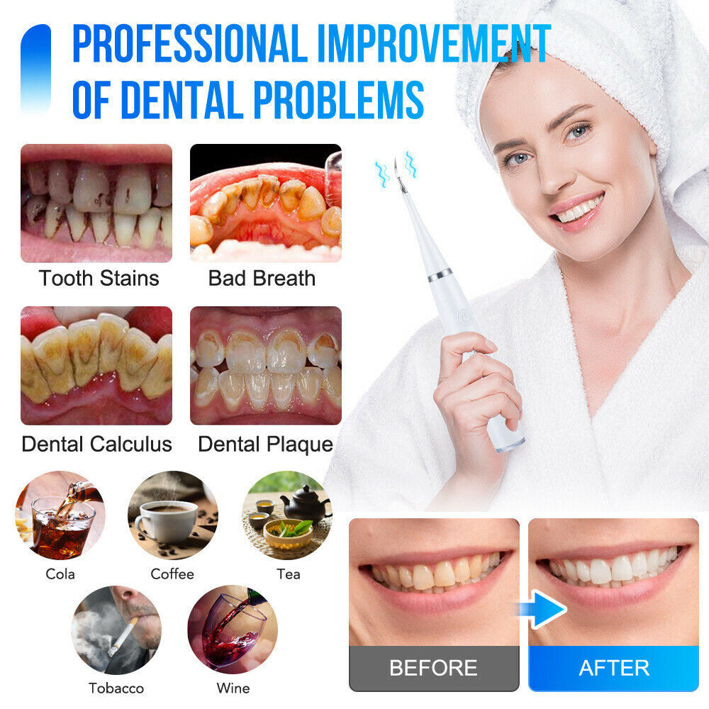 6in1 Electric Toothbrush Ultrasonic Tooth Cleaner Teeth Stains Plaque Remover