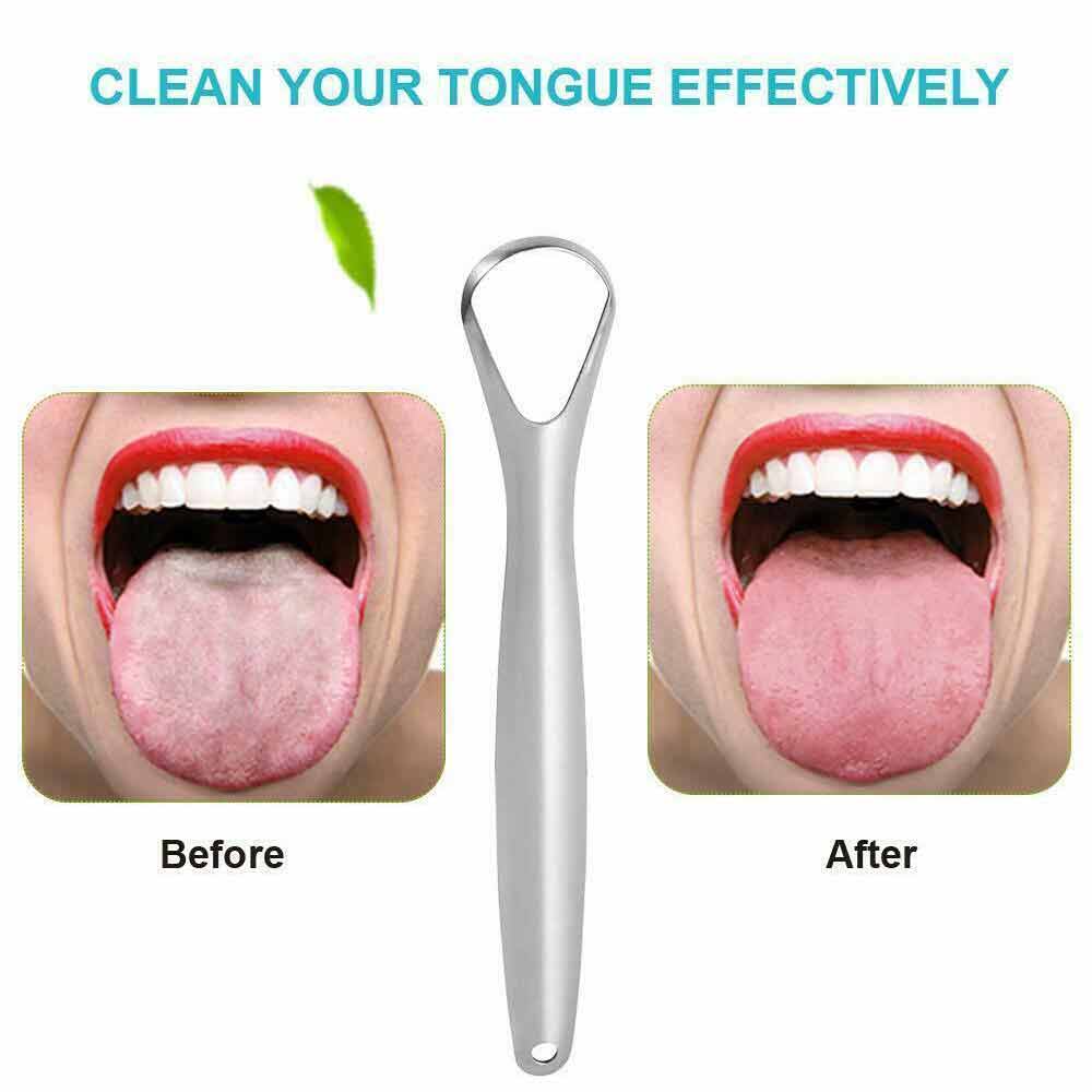 2PCS Kit Stainless Steel Tongue Tounge Cleaner Dental Care Hygiene Oral Mouth
