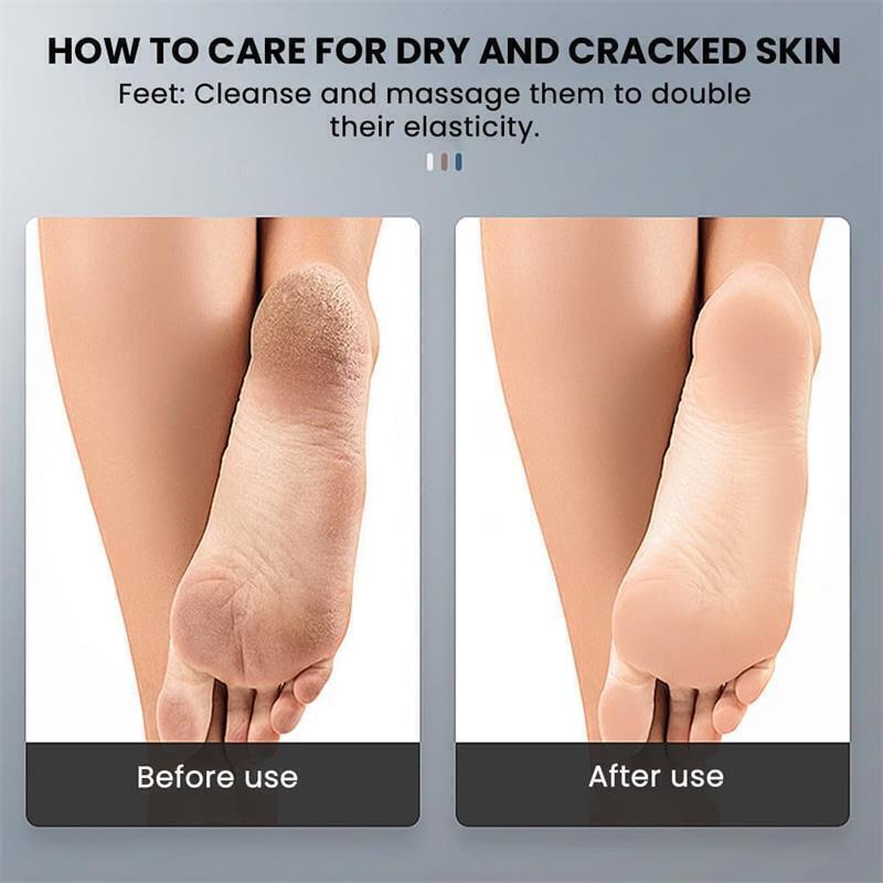 Professional Electric Foot Grinder File Callus Dead Skin Remover Pedicure Tool Free Tips