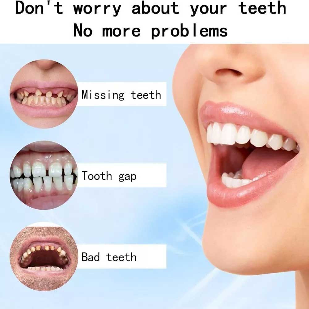 Teeth Comfort Fit Silicone Denture Set for Dentures & Veneers | Instant Smile Makeover