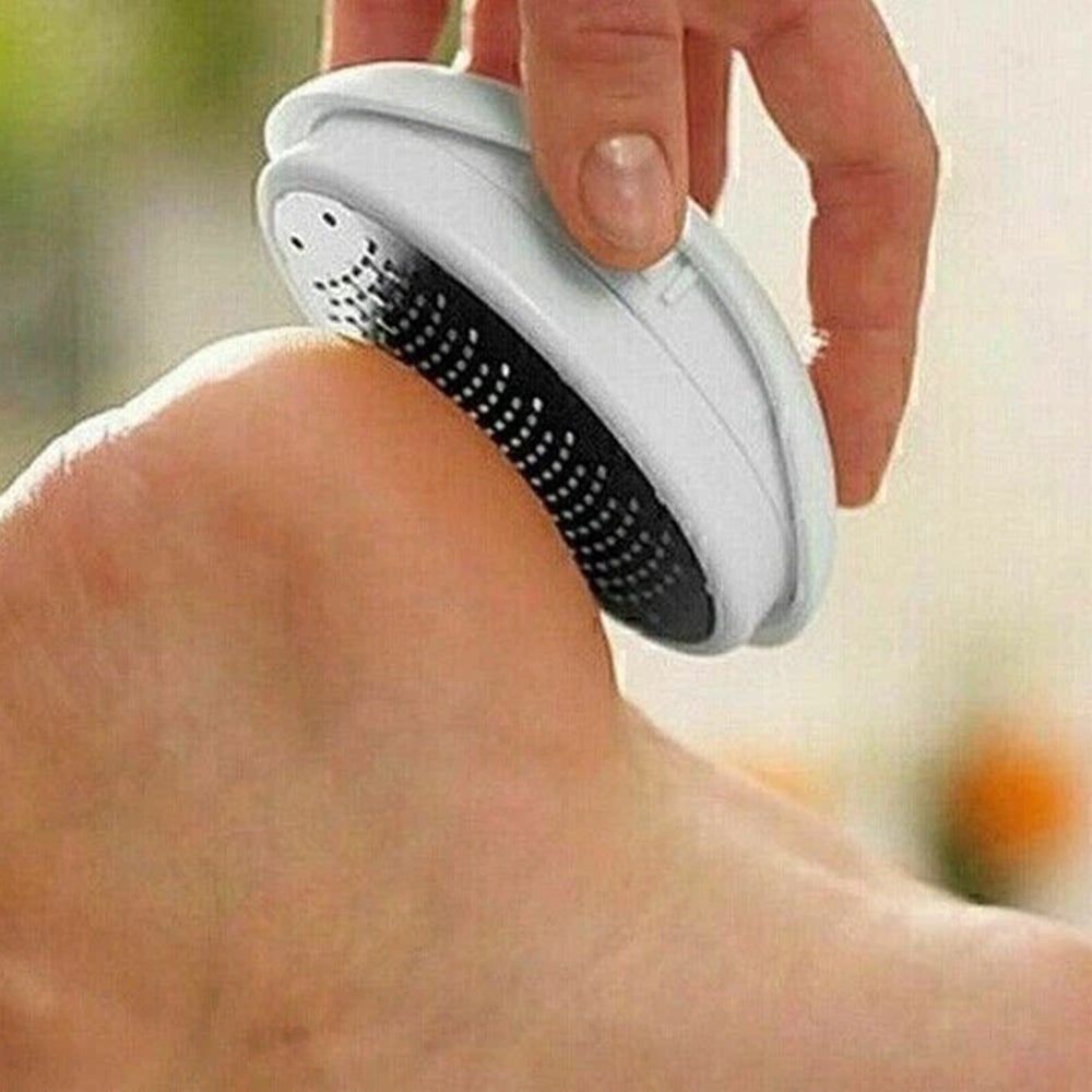 Ped Egg Foot File Callus Remover Foot Care Hard Skin Remover Pedicure Tool