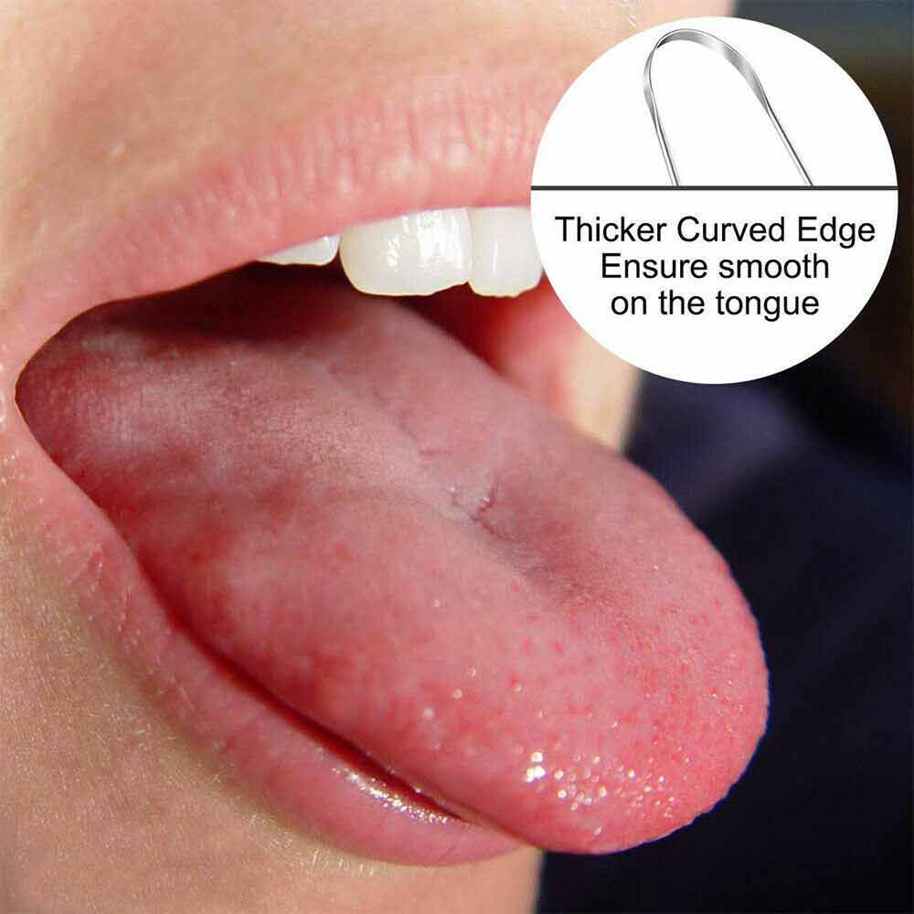 2PCS Kit Stainless Steel Tongue Tounge Cleaner Dental Care Hygiene Oral Mouth